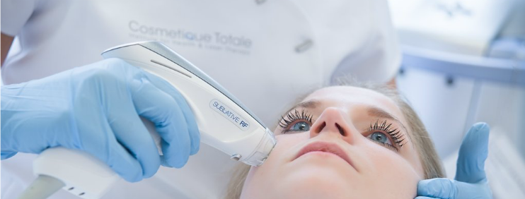 Huidtherapie laser